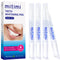 Mitimi Teeth Whitening Pens (4 Pack) Painless, No Sensitivity, Travel-Friendly, Mint Flavor
